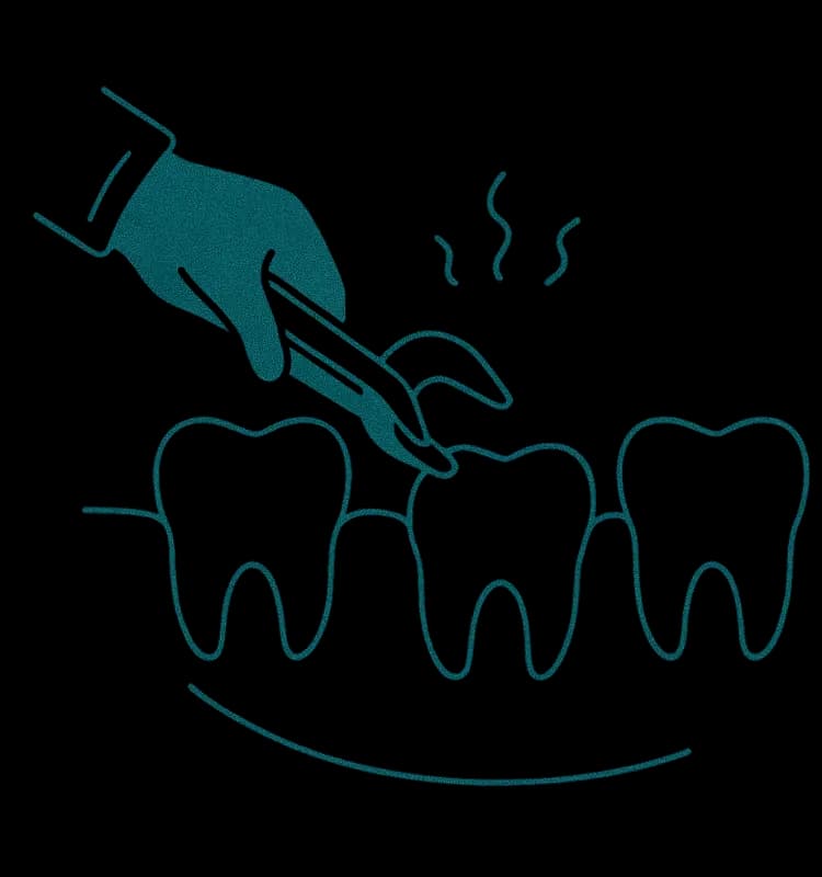 Wisdom Teeth Removal in Monroe, CT consultation illustration