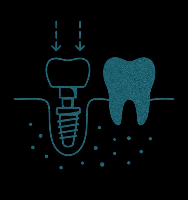 Dental Implants in Shelton, CT consultation illustration